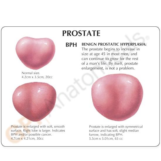 prostate gland lobes
