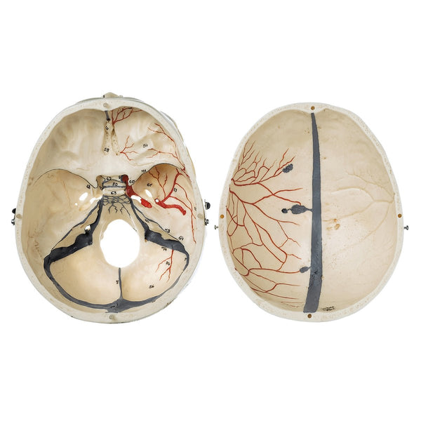 Somso Model Of The Artificial Human Skull English And Latin