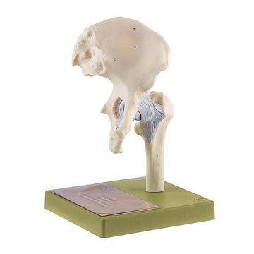 1. Hip Joint Models