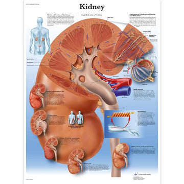 1. Kidney Charts