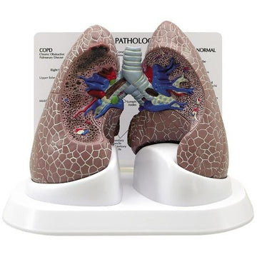 1. Respiratory System Pathologies