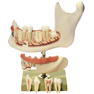 1. SOMSO Teeth and Jaw