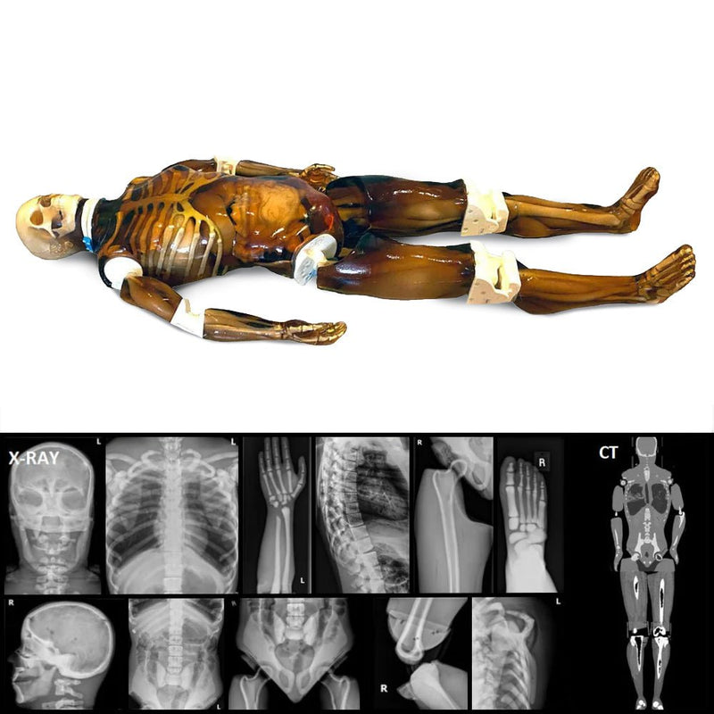 Adult Full Human Body Phantom for X-Ray, CT Scan and Ultrasound