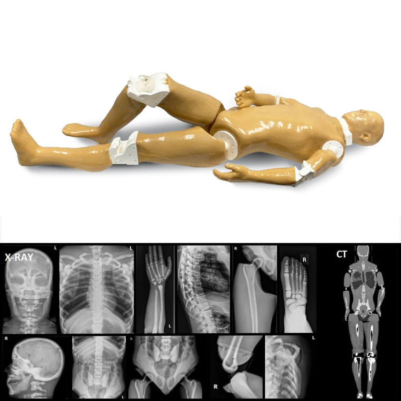 Adult Full Human Body Phantom for X-Ray, CT Scan and Ultrasound