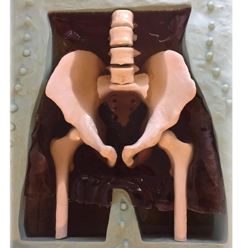 Adult Pelvis Phantom with Prostate for X-Ray CT and Ultrasound