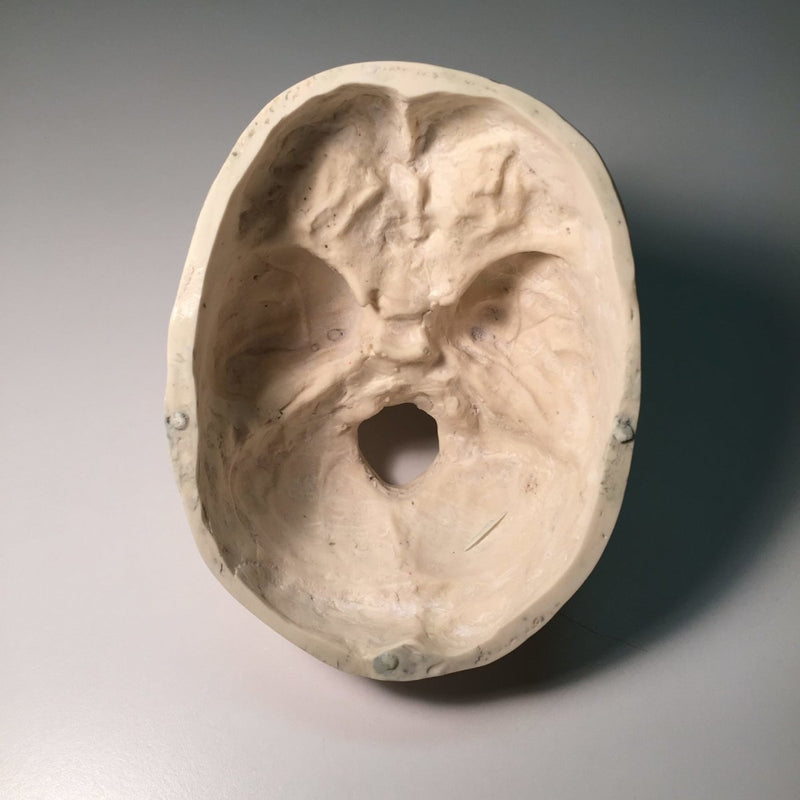 Adult Skull for X-Ray CT, Ultrasound and MRI