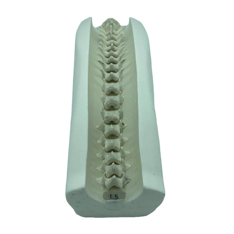 Adult Spine Phantom for X-Ray CT