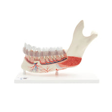 Advanced Half Lower Jaw with 8 Diseased Teeth