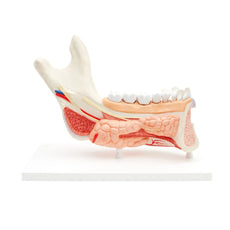 Advanced Half Lower Jaw with 8 Diseased Teeth