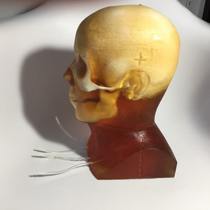 Dynamic Adult Head Phantom for Ultrasound, MRI and CT applications