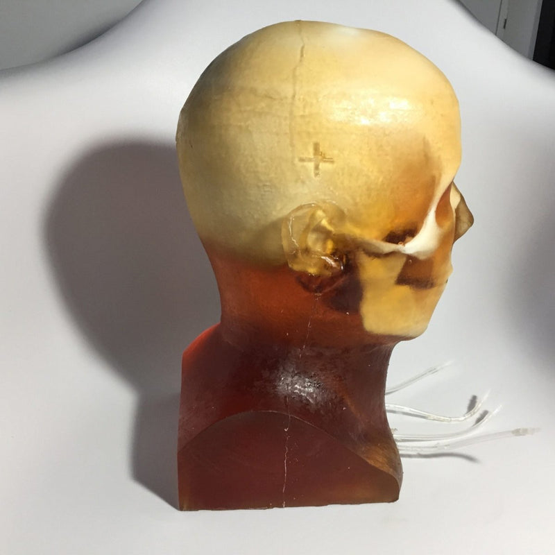 Dynamic Adult Head Phantom for Ultrasound, MRI and CT applications