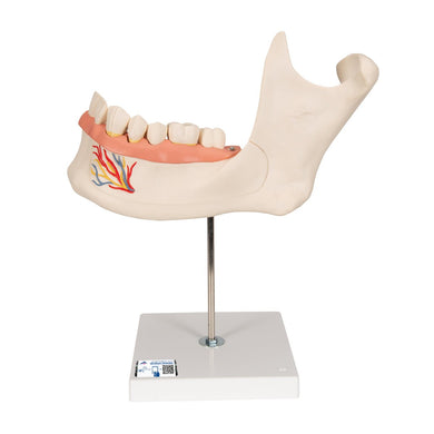 Half Lower Jaw Model, 3 times full-size, 6 part