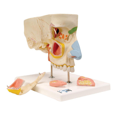 Nose Model with Paranasal Sinuses, 5 part