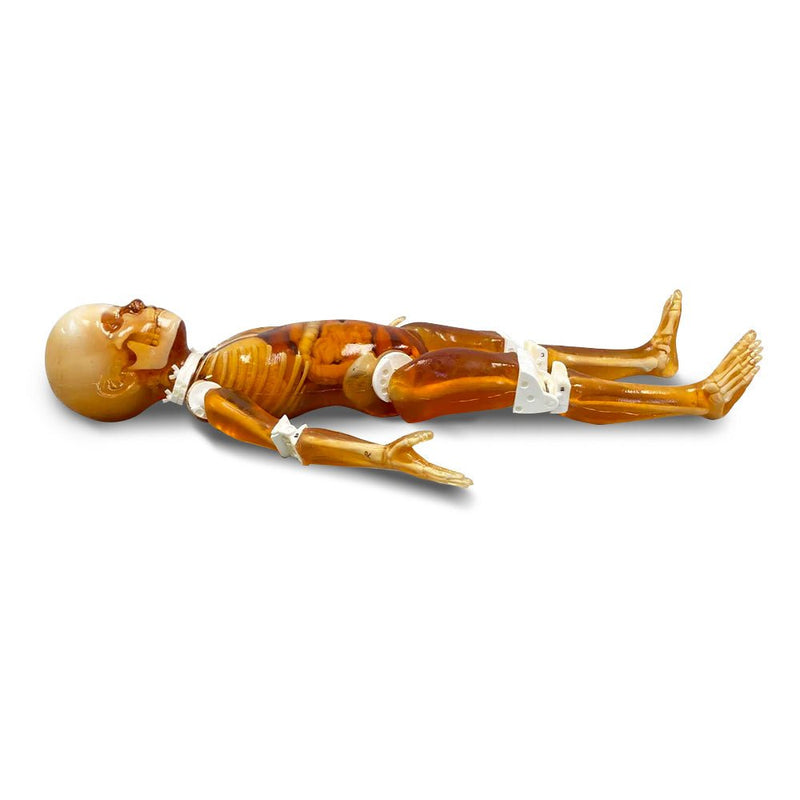 Pediatric Full Human Body Phantom for X-Ray CT & MRI Training