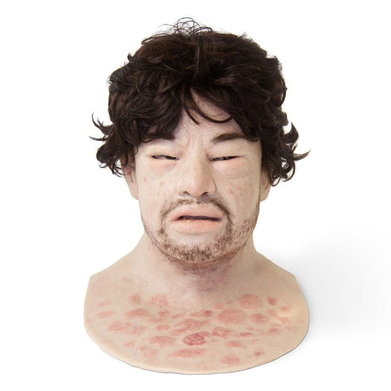 Realistic Facial Overlay 'Eduardo Anaphylaxis / stubble' for Adult Manikin Training Simulators