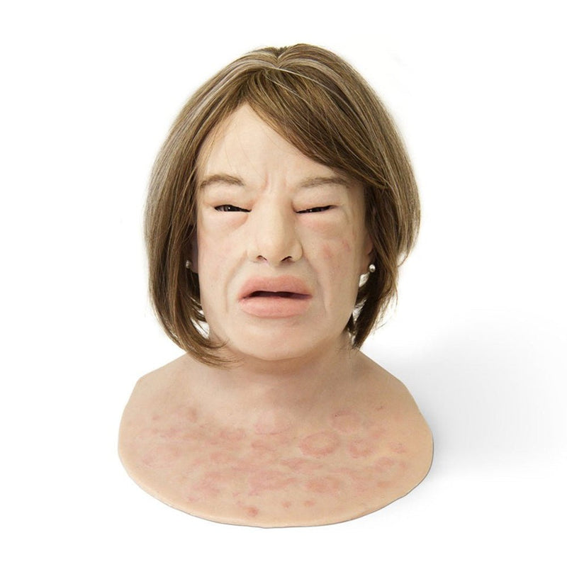 Realistic Facial Overlay 'Erica Anaphylaxis' for Adult Manikin Training Simulators