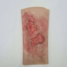 Scalding Burn Sleeve