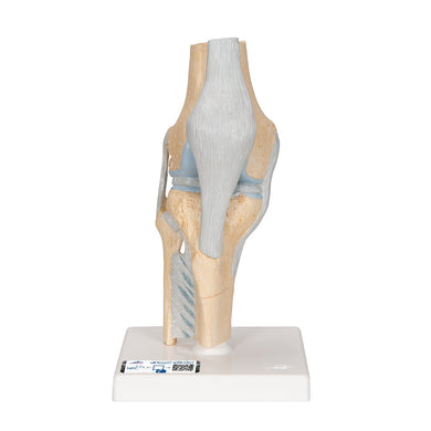 Sectional knee joint model, 3-part