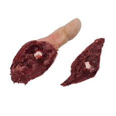 Severed Male Thumb With Wound