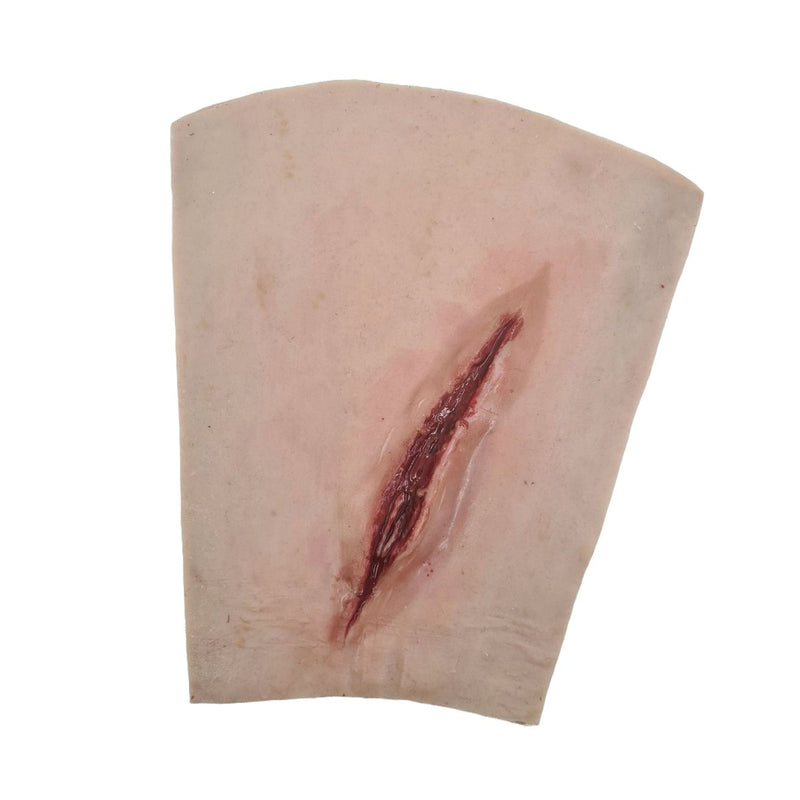 Suture Wrist laceration