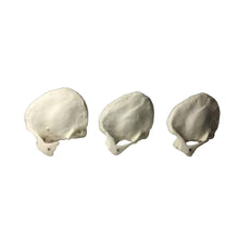 Temporal Bone Phantoms for X-Ray CT, Ultrasound and MRI