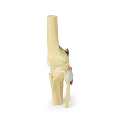 3D Printed Knee Joint extended Model