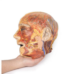 3D Printed Superficial Facial Nerves & Parotid Gland