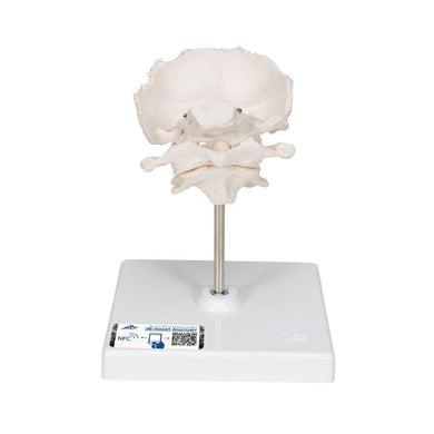 Atlas and Axis, with occipital plate