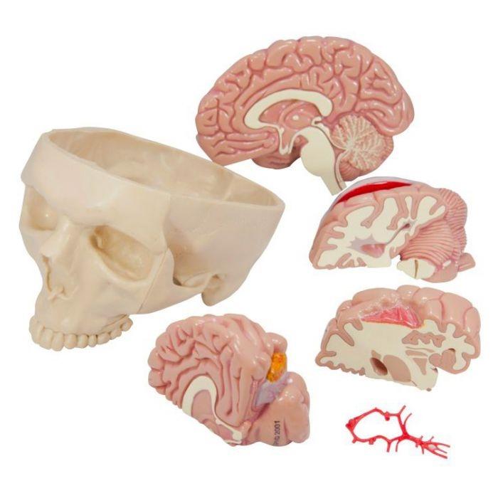 Human Skull Model With Brain, Health Edco