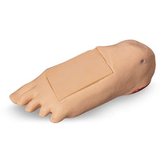 Edema Foot With Tissue Injury for GERi™-KERi™, Light Skin