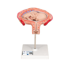 Fetus, Month 4, Abdominal Position