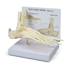 Foot-Ankle Model with Plantar Fasciitis