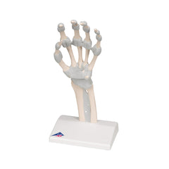 Hand Skeleton Model with Elastic Ligaments