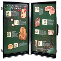 HIV/AIDS Consequences 3-D Display