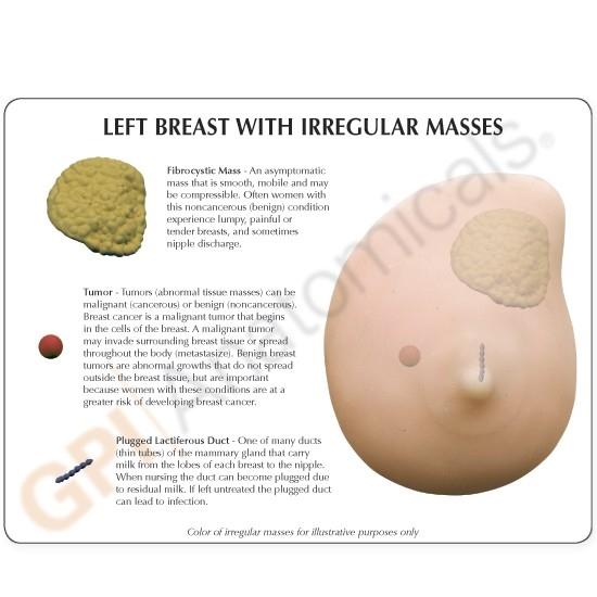 Breast Cancer Foundation - Boobs. We love 'em. They come in different shapes  and sizes and they ALL need TLC. At least once a month, check your breasts  for: ✓A persistent lump