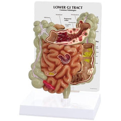 Lower GI Tract Model