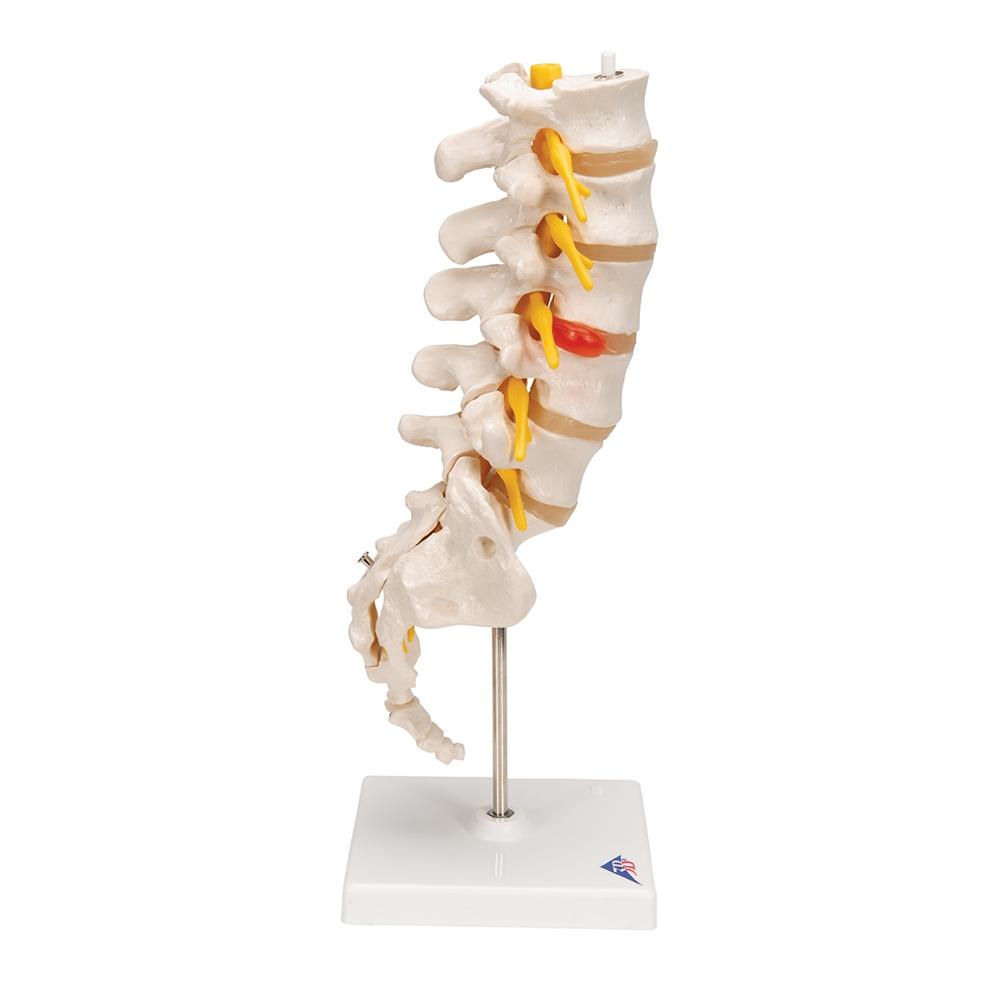 https://www.gtsimulators.com/cdn/shop/products/lumbar-spinal-column-with-dorso-lateral-prolapsed-intervertebral-disc-a76-5-114430_1000x.jpg?v=1671223924