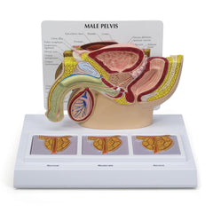 Male Pelvis with 3D Prostate Frame