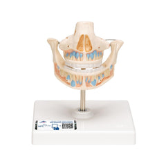 Milk Dentures - Upper and Lower Jaw