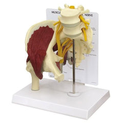 Muscled Hip Joint with Sciatic Nerve