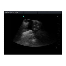 Paracentesis Ultrasound Training Model