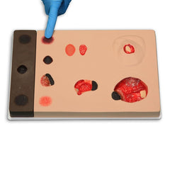 Pat Pressure Injury Staging Model