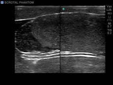 Scrotal Ultrasound Training Model