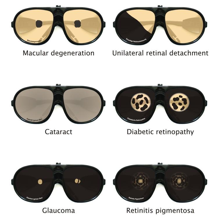 https://www.gtsimulators.com/cdn/shop/products/simulation-of-eye-diseases-ppd1003-533137.jpg?v=1657126192