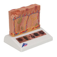 Skin Cancer Model