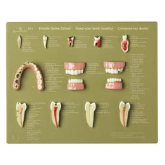 SOMSO Case of Teeth 'Keep your Teeth healthy'