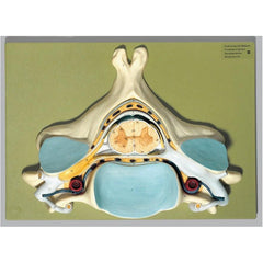 SOMSO Fifth Cervical Vertebra Model