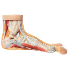 SOMSO Hallux Valgus Model