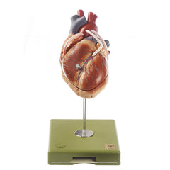 SOMSO Heart w- Bypass Vessels (Aortic Coronary Venous Bypass)