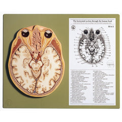 SOMSO Horizontal Section of the Head